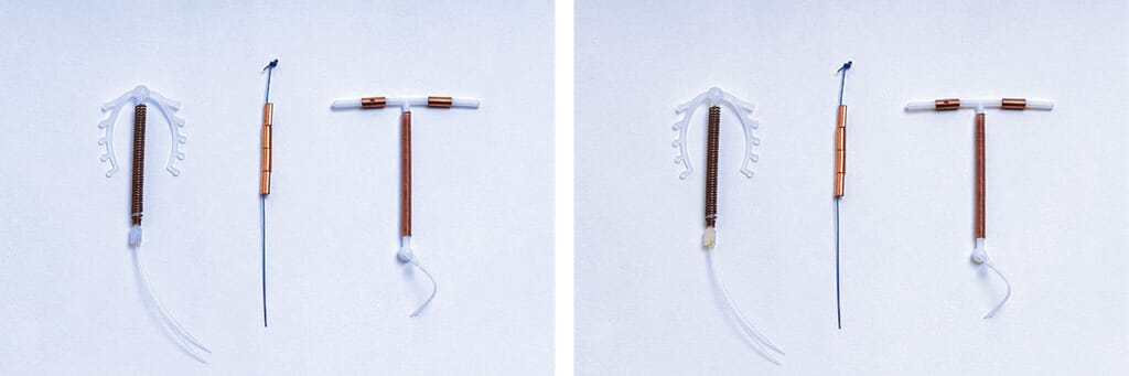 Copper toxicity IUD